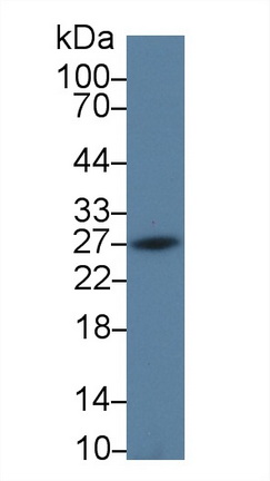 Western blot - Anti-PD-L2 antibody (AB231145), expandable thumbnail