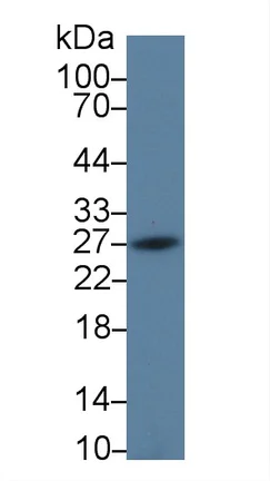 Western blot - Anti-PD-L2 antibody (AB231145)