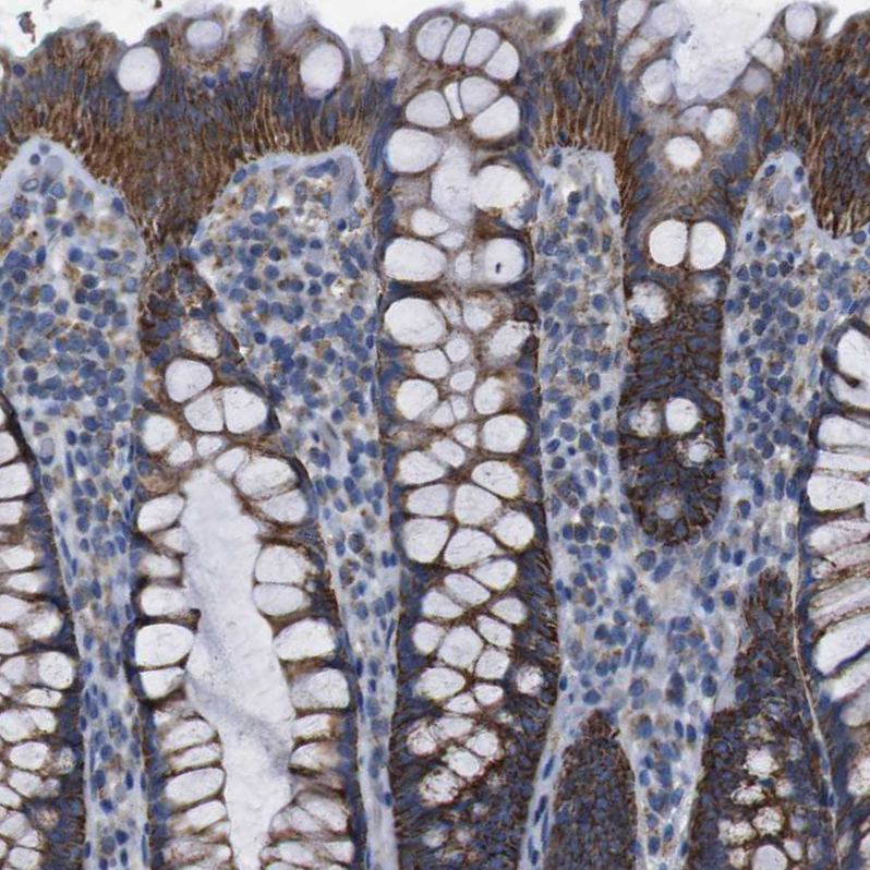 Immunohistochemistry (Formalin/PFA-fixed paraffin-embedded sections) - Anti-PD-L2 antibody (AB244332), expandable thumbnail