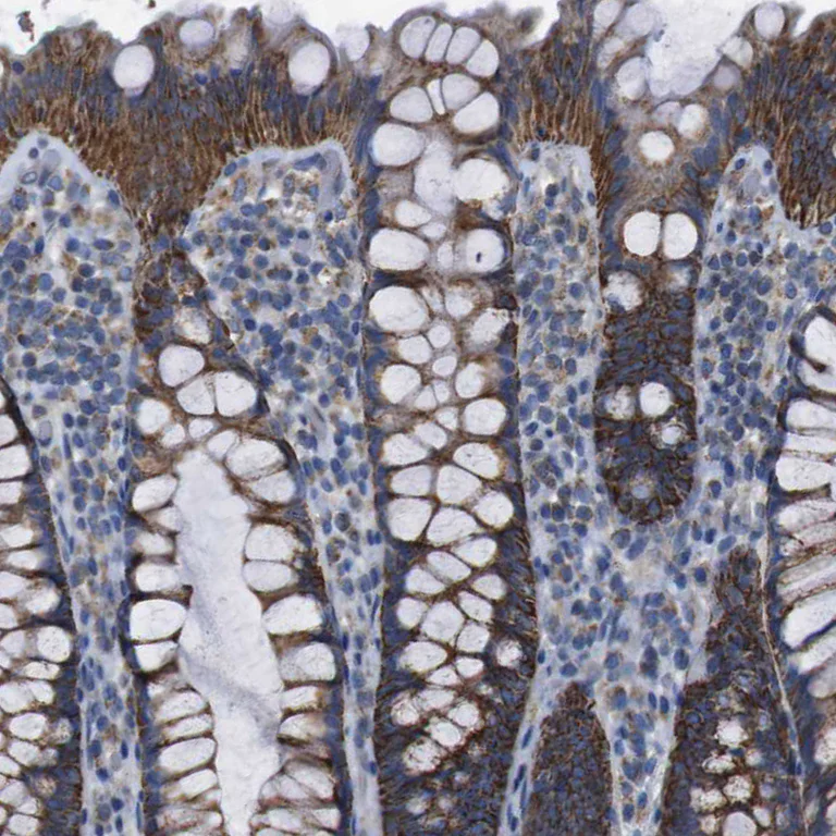 Immunohistochemistry (Formalin/PFA-fixed paraffin-embedded sections) - Anti-PD-L2 antibody (AB244332)