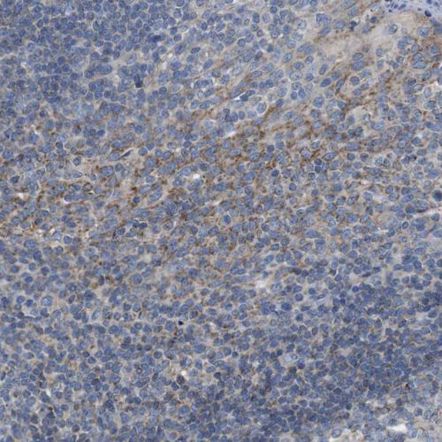 Immunohistochemistry (Formalin/PFA-fixed paraffin-embedded sections) - Anti-PD-L2 antibody (AB244332), expandable thumbnail