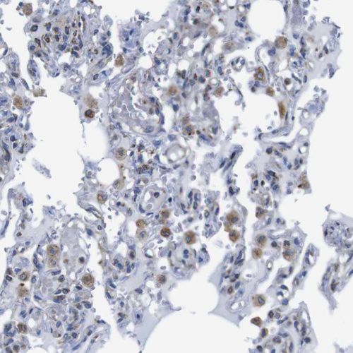 Immunohistochemistry (Formalin/PFA-fixed paraffin-embedded sections) - Anti-PD-L2 antibody (AB244332), expandable thumbnail