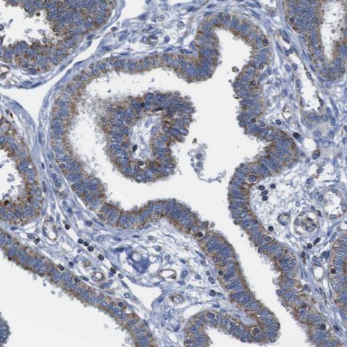 Immunohistochemistry (Formalin/PFA-fixed paraffin-embedded sections) - Anti-PD-L2 antibody (AB244332), expandable thumbnail