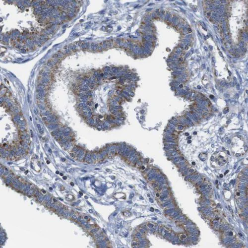 Immunohistochemistry (Formalin/PFA-fixed paraffin-embedded sections) - Anti-PD-L2 antibody (AB244332)