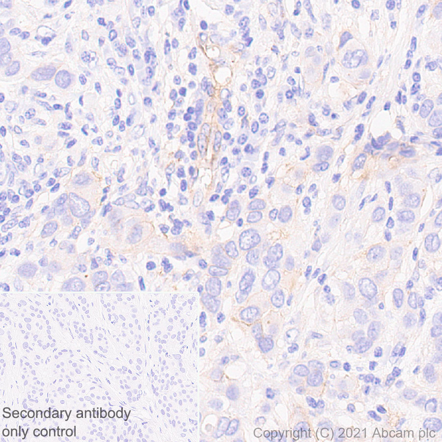 Immunohistochemistry (Formalin/PFA-fixed paraffin-embedded sections) - Anti-PD-L2 antibody [EPR25200-50] - BSA and Azide free (AB288308), expandable thumbnail