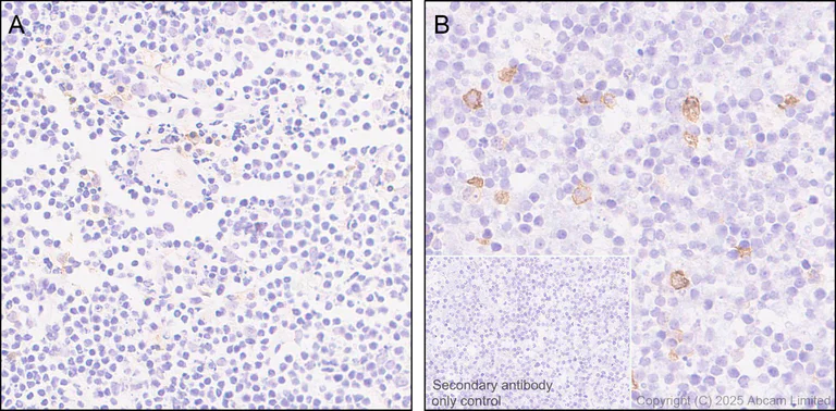 Immunohistochemistry (Formalin/PFA-fixed paraffin-embedded sections) - Anti-PD-L2 antibody [EPR30468-16] (AB325173)