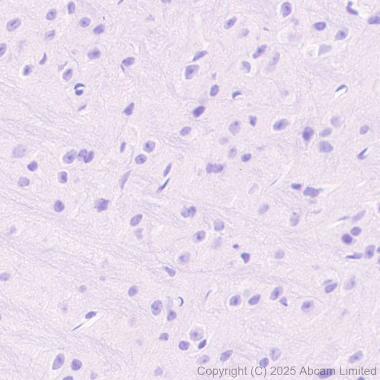 Immunohistochemistry (Formalin/PFA-fixed paraffin-embedded sections) - Anti-PD-L2 antibody [EPR30468-16] (AB325173)