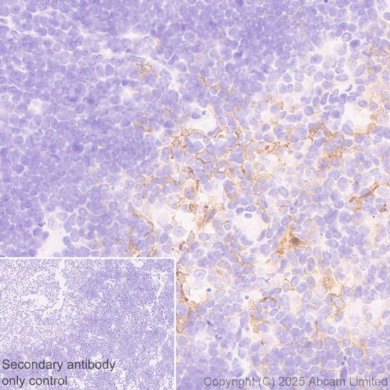Immunohistochemistry (Formalin/PFA-fixed paraffin-embedded sections) - Anti-PD-L2 antibody [EPR30468-16] - BSA and Azide free (AB325187)