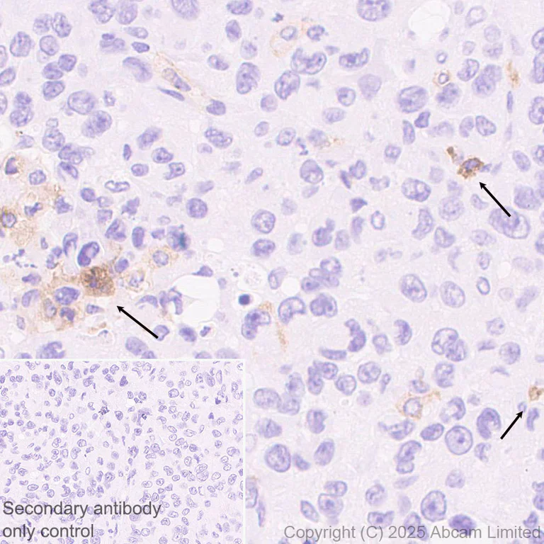Immunohistochemistry (Formalin/PFA-fixed paraffin-embedded sections) - Anti-PD-L2 antibody [EPR30468-16] - BSA and Azide free (AB325187)