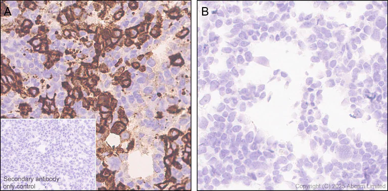 Immunohistochemistry (Formalin/PFA-fixed paraffin-embedded sections) - Anti-PD-L2 antibody [EPR30468-16] - BSA and Azide free (AB325187)
