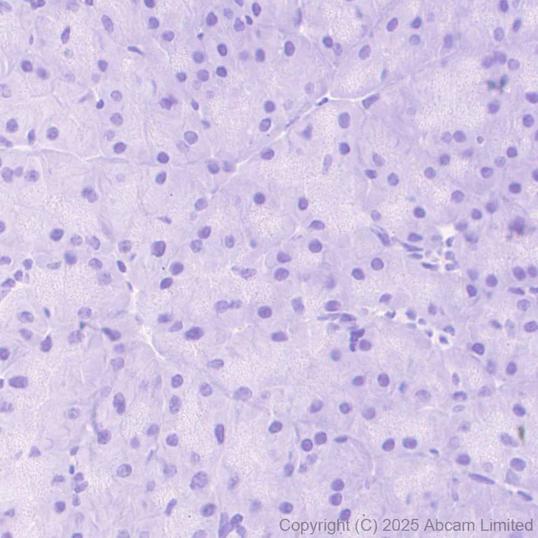 Immunohistochemistry (Formalin/PFA-fixed paraffin-embedded sections) - Anti-PD-L2 antibody [EPR30468-16] - BSA and Azide free (AB325187)