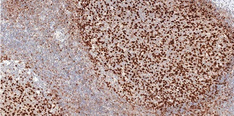 Immunohistochemistry (Formalin/PFA-fixed paraffin-embedded sections) - Anti-PD1 antibody [CAL15] (AB237727)