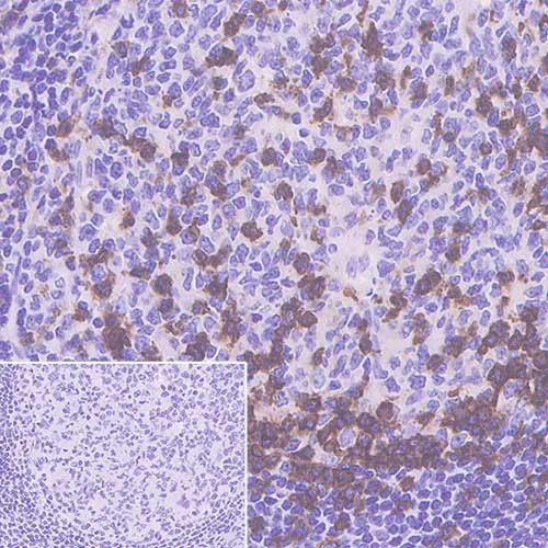 Immunohistochemistry (Formalin/PFA-fixed paraffin-embedded sections) - Anti-PD1 antibody [CAL15] (AB237727)