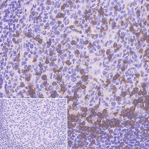 Immunohistochemistry (Formalin/PFA-fixed paraffin-embedded sections) - Anti-PD1 antibody [CAL15] - BSA and Azide free (AB251612)