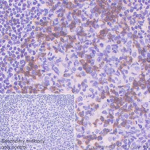 Immunohistochemistry (Formalin/PFA-fixed paraffin-embedded sections) - Anti-PD1 antibody [CAL20] (AB237728)