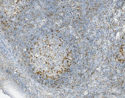 Immunohistochemistry (Formalin/PFA-fixed paraffin-embedded sections) - Anti-PD1 antibody [CAL20] (AB237728)