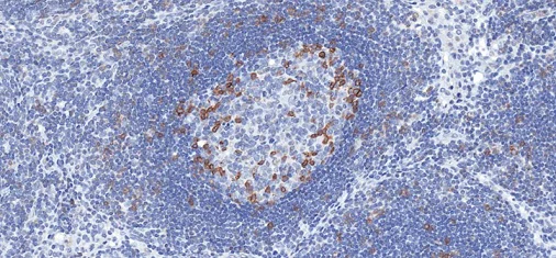 Immunohistochemistry (Formalin/PFA-fixed paraffin-embedded sections) - Anti-PD1 antibody [CAL20] - BSA and Azide free (AB251613)