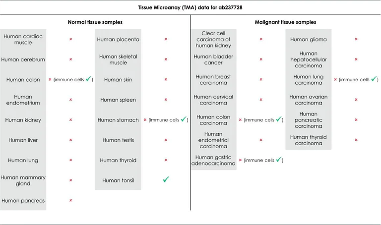 Immunohistochemistry (Formalin/PFA-fixed paraffin-embedded sections) - Anti-PD1 antibody [CAL20] - BSA and Azide free (AB251613)
