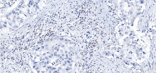 Immunohistochemistry (Formalin/PFA-fixed paraffin-embedded sections) - Anti-PD1 antibody [CAL20] - BSA and Azide free (AB251613)