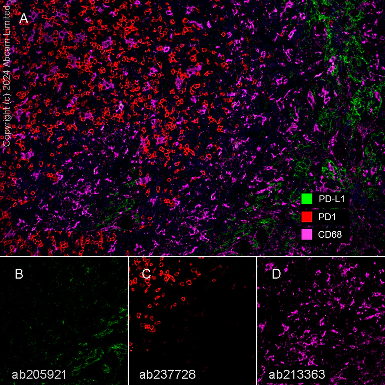 Multiplex immunohistochemistry - Anti-PD1 antibody [CAL20] - BSA and Azide free (AB251613)