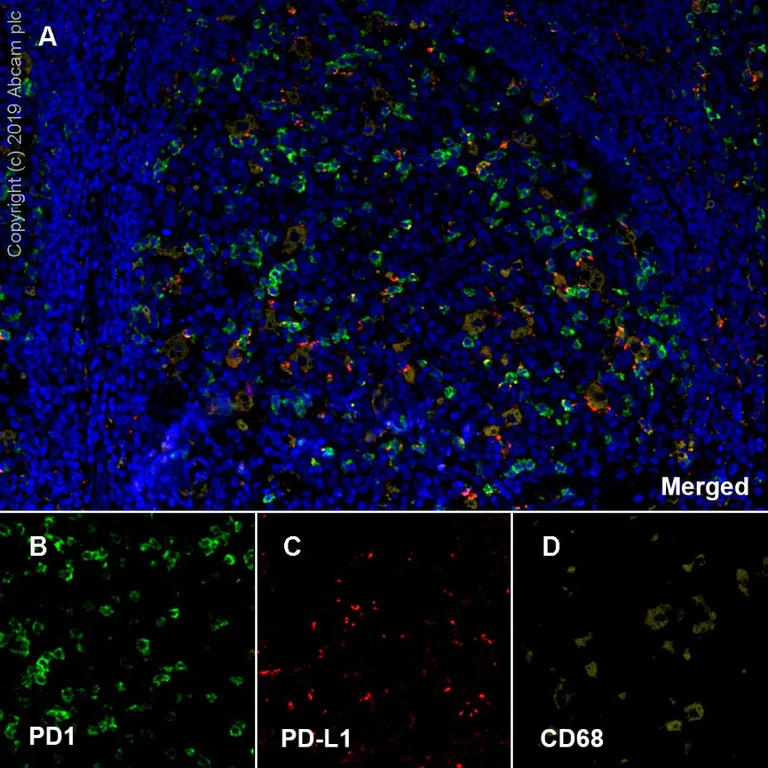 Immunohistochemistry (Formalin/PFA-fixed paraffin-embedded sections) - Anti-PD1 antibody [EPR23119-111] (AB243644)