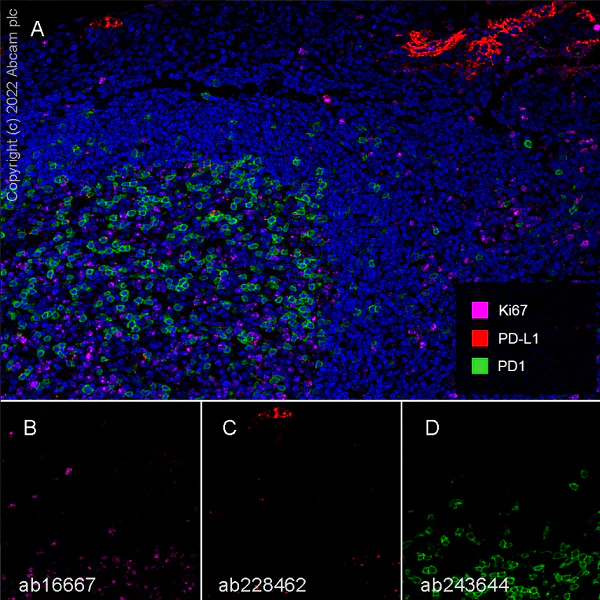 Multiplex immunohistochemistry - Anti-PD1 antibody [EPR23119-111] (AB243644)