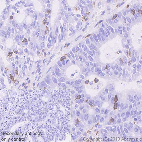 Immunohistochemistry (Formalin/PFA-fixed paraffin-embedded sections) - Anti-PD1 antibody [EPR23119-111] - BSA and Azide free (AB270753), expandable thumbnail