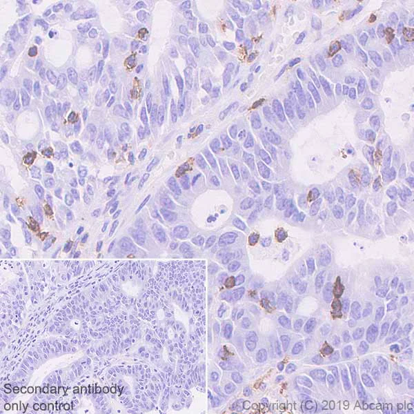 Immunohistochemistry (Formalin/PFA-fixed paraffin-embedded sections) - Anti-PD1 antibody [EPR23119-111] - BSA and Azide free (AB270753)