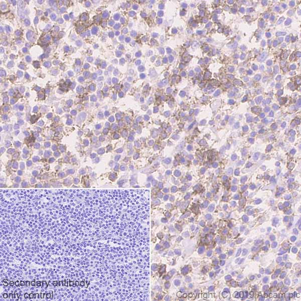 Immunohistochemistry (Formalin/PFA-fixed paraffin-embedded sections) - Anti-PD1 antibody [EPR23119-111] - BSA and Azide free (AB270753), expandable thumbnail