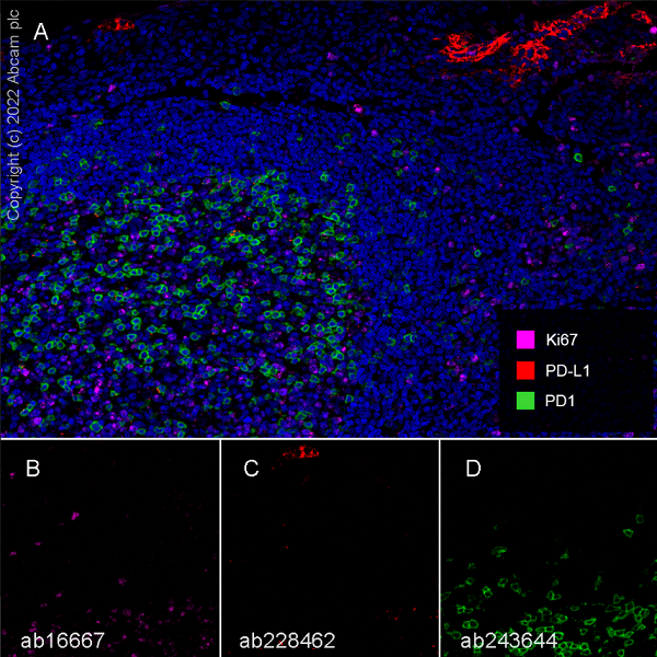 Multiplex immunohistochemistry - Anti-PD1 antibody [EPR23119-111] - BSA and Azide free (AB270753), expandable thumbnail