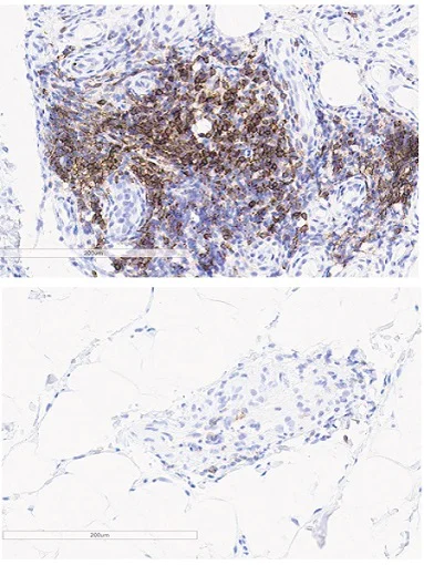 Immunohistochemistry (Formalin/PFA-fixed paraffin-embedded sections) - Anti-PD1 antibody [EPR4877(2)] (AB137132)