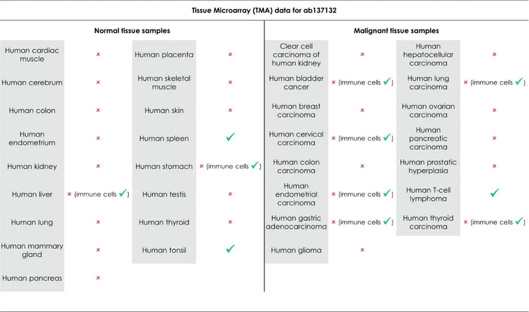 Immunohistochemistry (Formalin/PFA-fixed paraffin-embedded sections) - Anti-PD1 antibody [EPR4877(2)] (AB137132)
