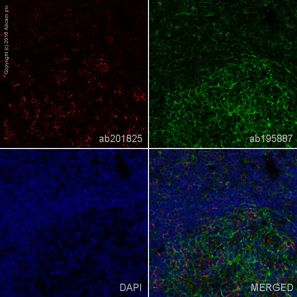Immunohistochemistry (Formalin/PFA-fixed paraffin-embedded sections) - Anti-PD1 antibody [EPR4877(2)] - BSA and Azide free (AB186928)