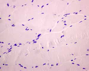Immunohistochemistry (Formalin/PFA-fixed paraffin-embedded sections) - Anti-PD1 antibody [EPR4877(2)] - BSA and Azide free (ab186928), expandable thumbnail