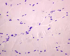 Immunohistochemistry (Formalin/PFA-fixed paraffin-embedded sections) - Anti-PD1 antibody [EPR4877(2)] - BSA and Azide free (AB186928)