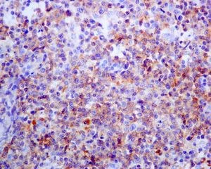 Immunohistochemistry (Formalin/PFA-fixed paraffin-embedded sections) - Anti-PD1 antibody [EPR4877(2)] - BSA and Azide free (AB186928)