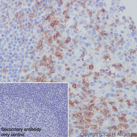 最大80％OFF - 『在庫ロス売買マーケット』 [EPR4877(2)] antibody Anti-PD1 - free Azide and BSA 健康・医学