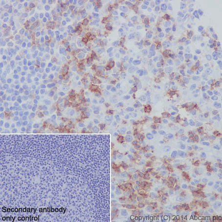 Immunohistochemistry (Formalin/PFA-fixed paraffin-embedded sections) - Anti-PD1 antibody [EPR4877(2)] - BSA and Azide free (AB186928)