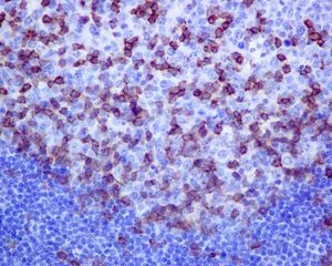 Immunohistochemistry (Formalin/PFA-fixed paraffin-embedded sections) - Anti-PD1 antibody [EPR4877(2)] - BSA and Azide free (AB186928)