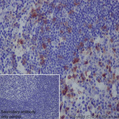 Immunohistochemistry (Formalin/PFA-fixed paraffin-embedded sections) - Anti-PD1 antibody [EPR4877(2)] - BSA and Azide free (AB186928)
