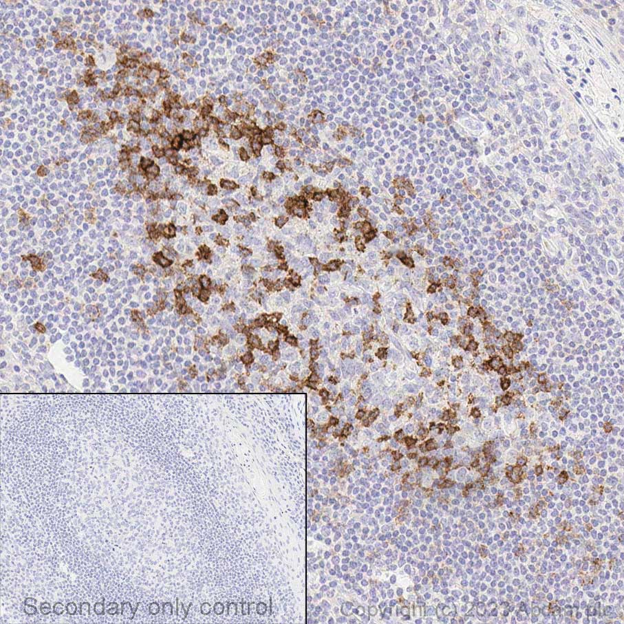 Immunohistochemistry (Formalin/PFA-fixed paraffin-embedded sections) - Anti-PD1 antibody [EPR4877(2)] - BSA and Azide free (ab186928), expandable thumbnail
