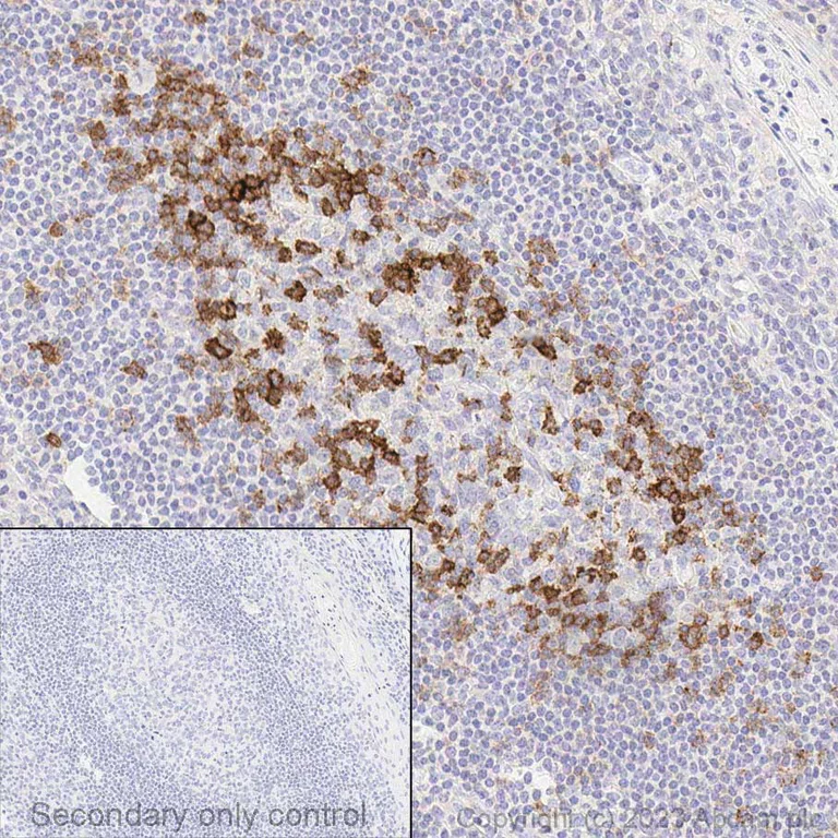 Immunohistochemistry (Formalin/PFA-fixed paraffin-embedded sections) - Anti-PD1 antibody [EPR4877(2)] - BSA and Azide free (AB186928)