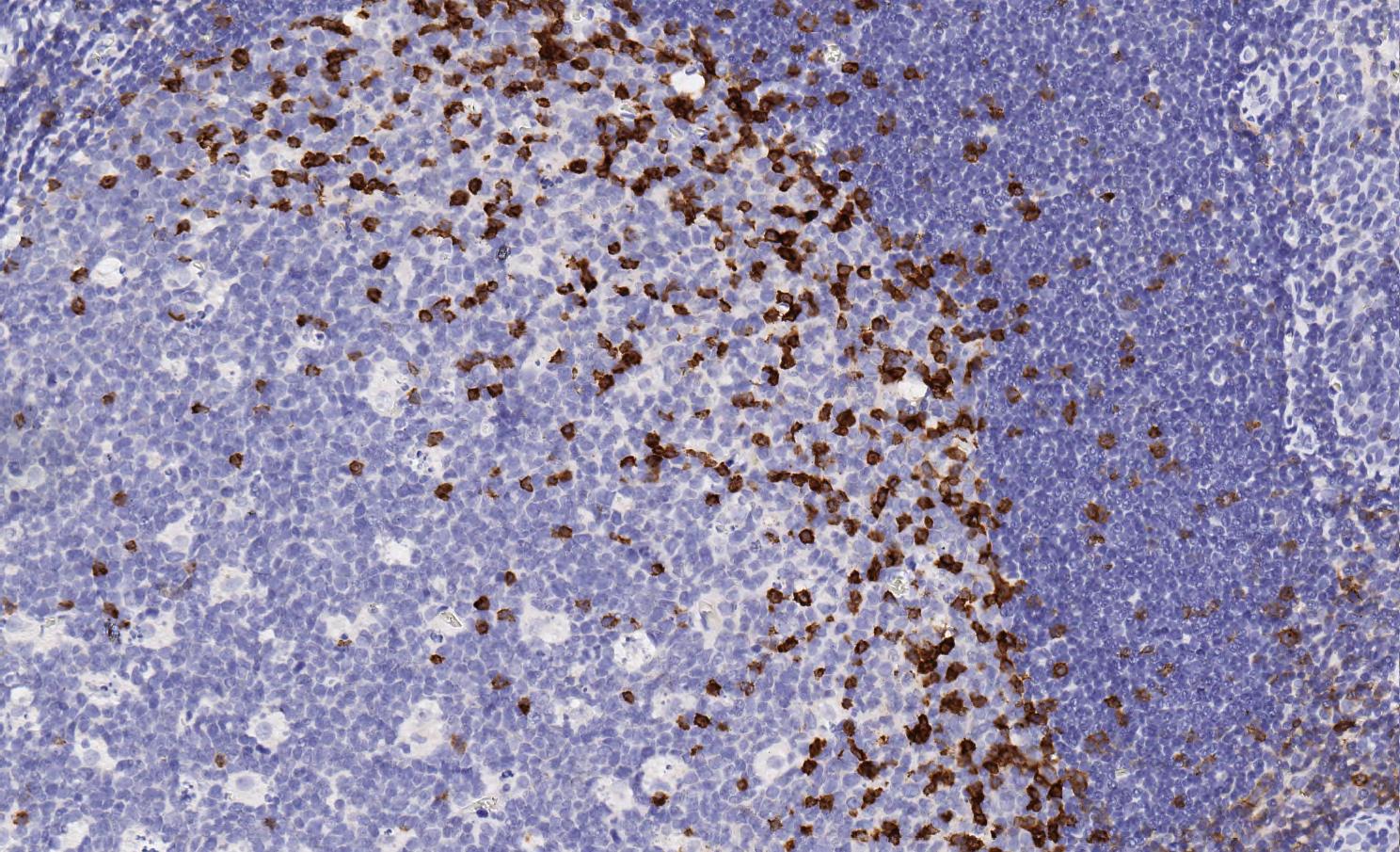 Immunohistochemistry (Formalin/PFA-fixed paraffin-embedded sections) - Anti-PD1 antibody [EPR4877(2)] - BSA and Azide free (AB186928), expandable thumbnail