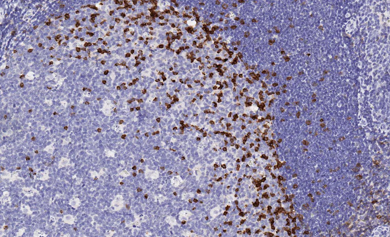 Immunohistochemistry (Formalin/PFA-fixed paraffin-embedded sections) - Anti-PD1 antibody [EPR4877(2)] - BSA and Azide free (AB186928)