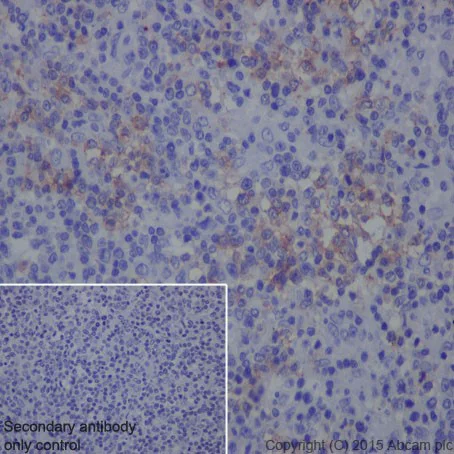 Immunohistochemistry (Formalin/PFA-fixed paraffin-embedded sections) - Anti-PD1 antibody [EPR4877(2)] - BSA and Azide free (AB186928)