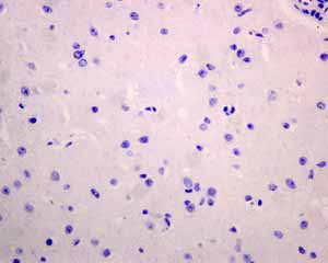 Immunohistochemistry (Formalin/PFA-fixed paraffin-embedded sections) - Anti-PD1 antibody [EPR4877(2)] - BSA and Azide free (AB186928), expandable thumbnail
