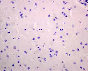 Immunohistochemistry (Formalin/PFA-fixed paraffin-embedded sections) - Anti-PD1 antibody [EPR4877(2)] - BSA and Azide free (AB186928)