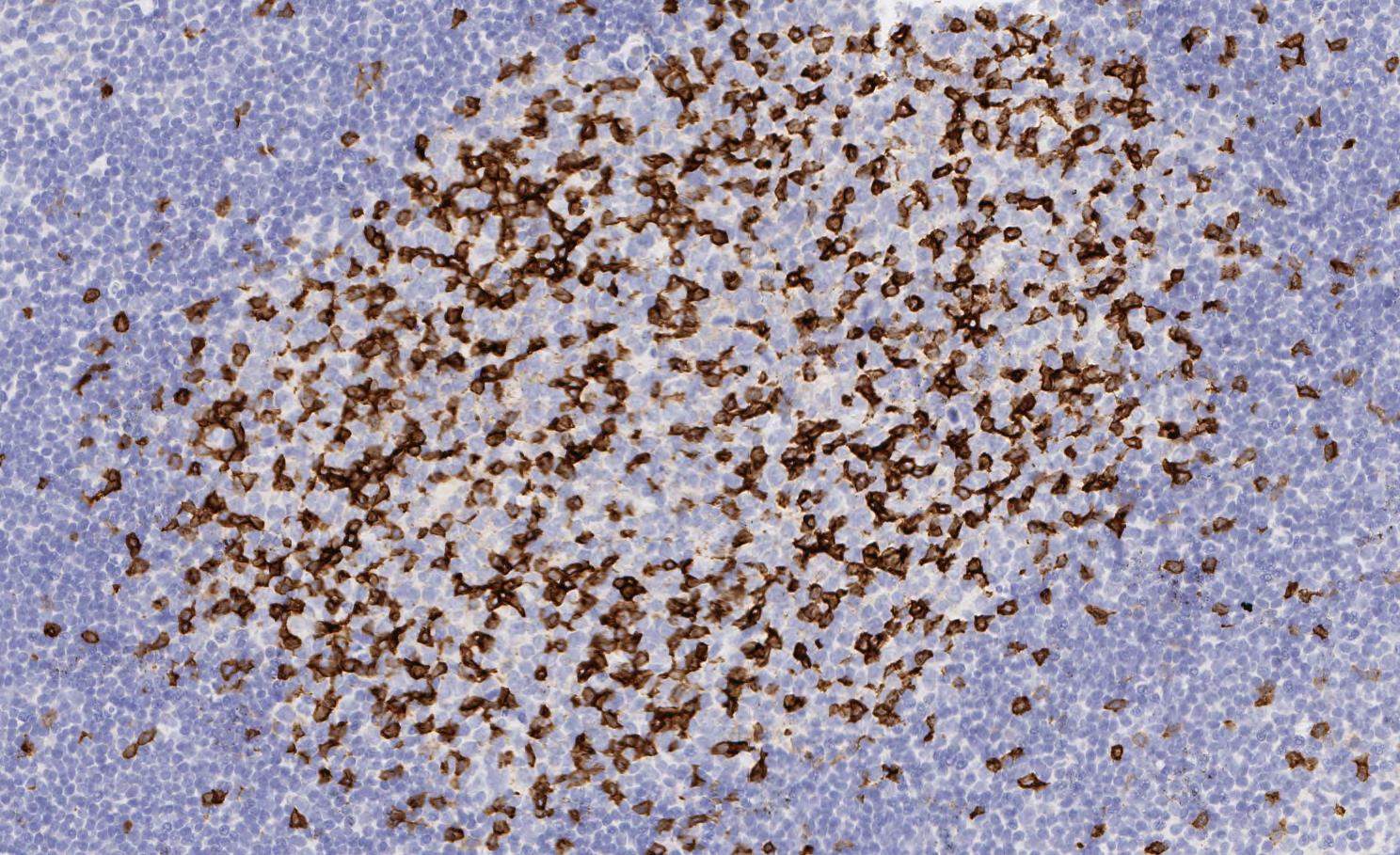 Immunohistochemistry (Formalin/PFA-fixed paraffin-embedded sections) - Anti-PD1 antibody [EPR4877(2)] - BSA and Azide free (AB186928), expandable thumbnail