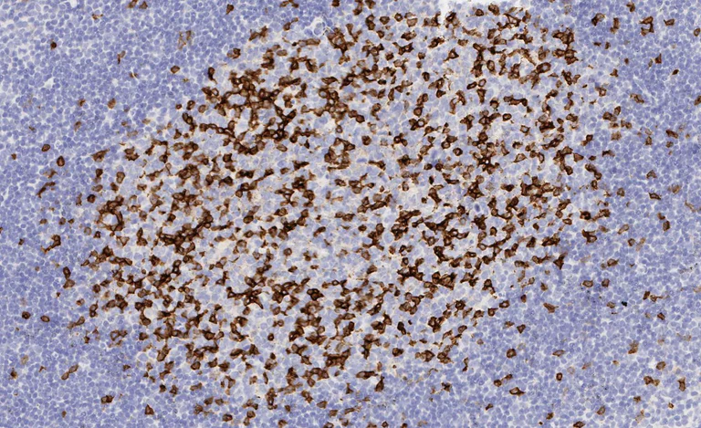 Immunohistochemistry (Formalin/PFA-fixed paraffin-embedded sections) - Anti-PD1 antibody [EPR4877(2)] - BSA and Azide free (AB186928)
