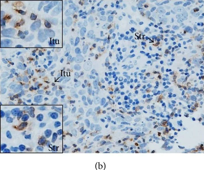 Immunohistochemistry (Formalin/PFA-fixed paraffin-embedded sections) - Anti-PD1 antibody [NAT105] (AB52587)